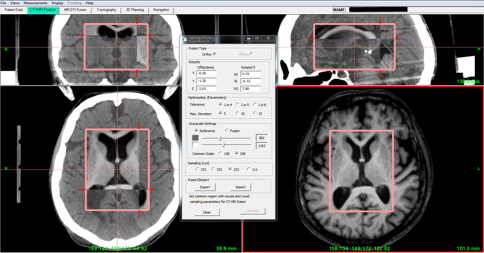 ctmrfusion