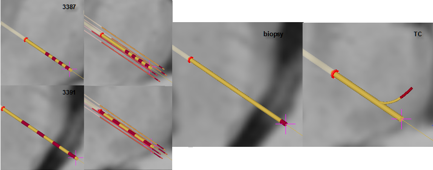 electrode_models